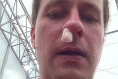 picked up the nickname Tampon my nose leaks so much
